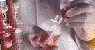 Fibrocystic breast cell culture